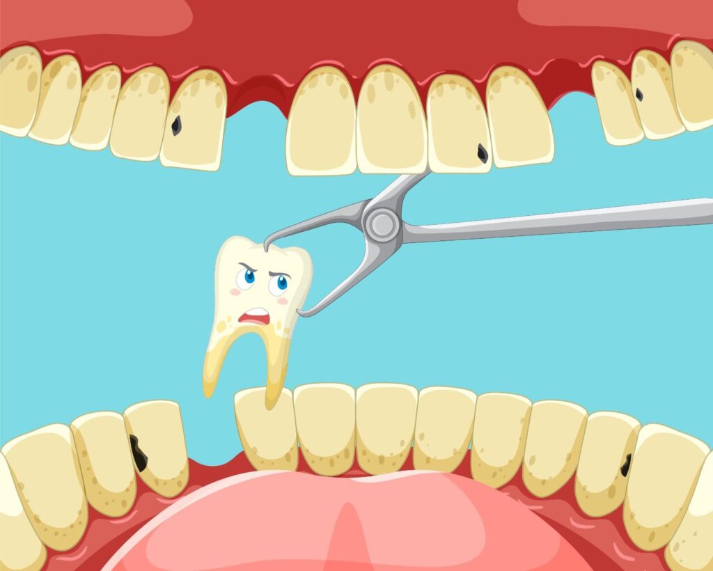 Rotten Broken Tooth