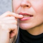 gum bumps