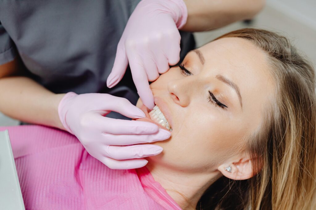 Wisdom Teeth Stitches