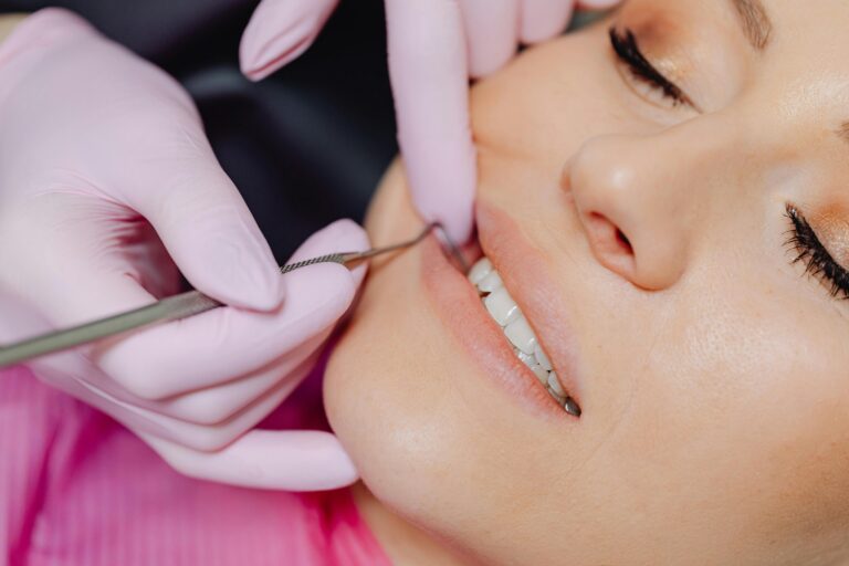 Teeth Stitches