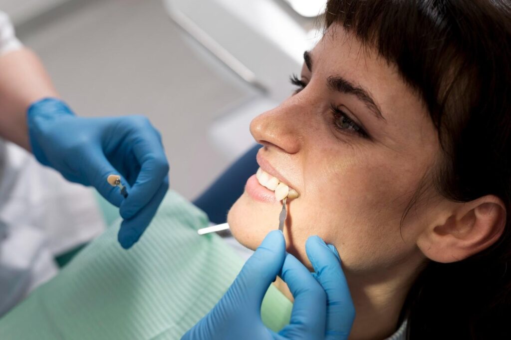 No-Prep-Veneers