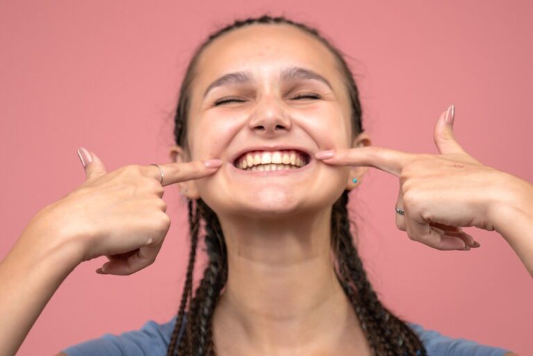 Prep Veneers