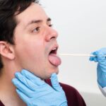 Tongue Tie