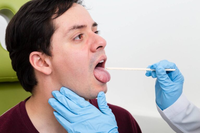 Tongue Tie