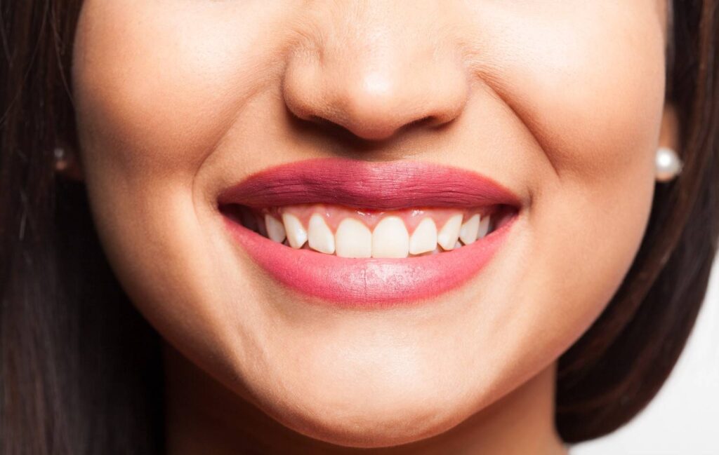 Woman showing healthy gums and clean teeth for better oral health.