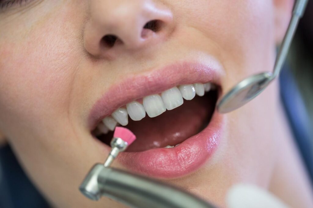 Dentist using an ultrasonic scaler to remove plaque and tartar during a deep cleaning teeth procedure.