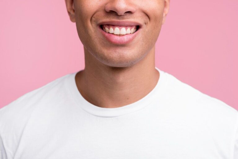 Man showing a gummy smile with visible upper gums and teeth