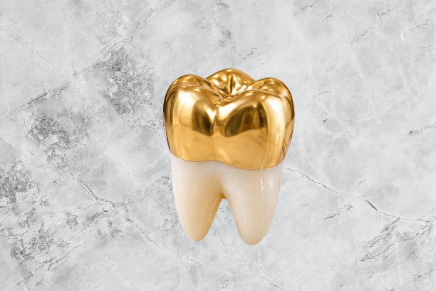 Gold crown tooth showing a dental gold crown on a molar