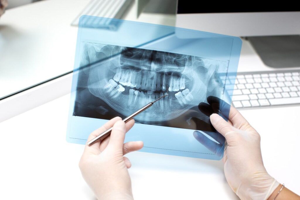 Dentist analyzing a panoramic dental X-ray